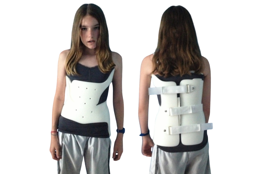 Boston Brace for Scoliosis