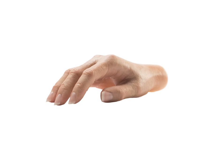 Partial Hand Prosthesis